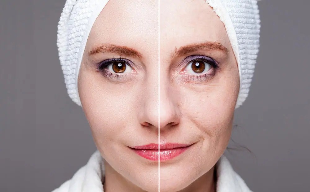 قبل و بعد استفاده از ماسک ضد لک صورت